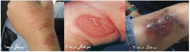 بی قاب